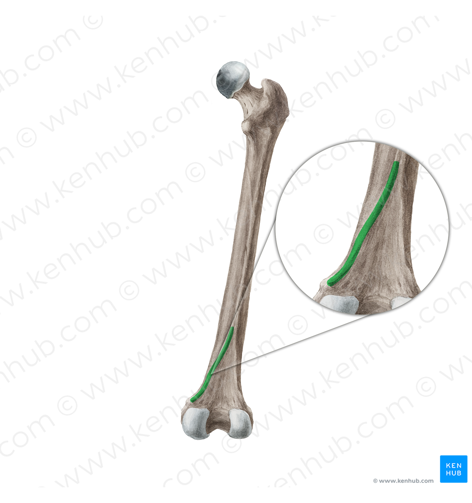 Medial supracondylar line of femur (#18274)