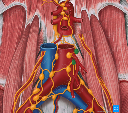 Lateral aortic lymph nodes (#6951)