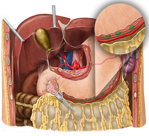 Right gastroomental lymph nodes (#7001)