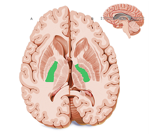 Posterior limb of internal capsule (#20571)