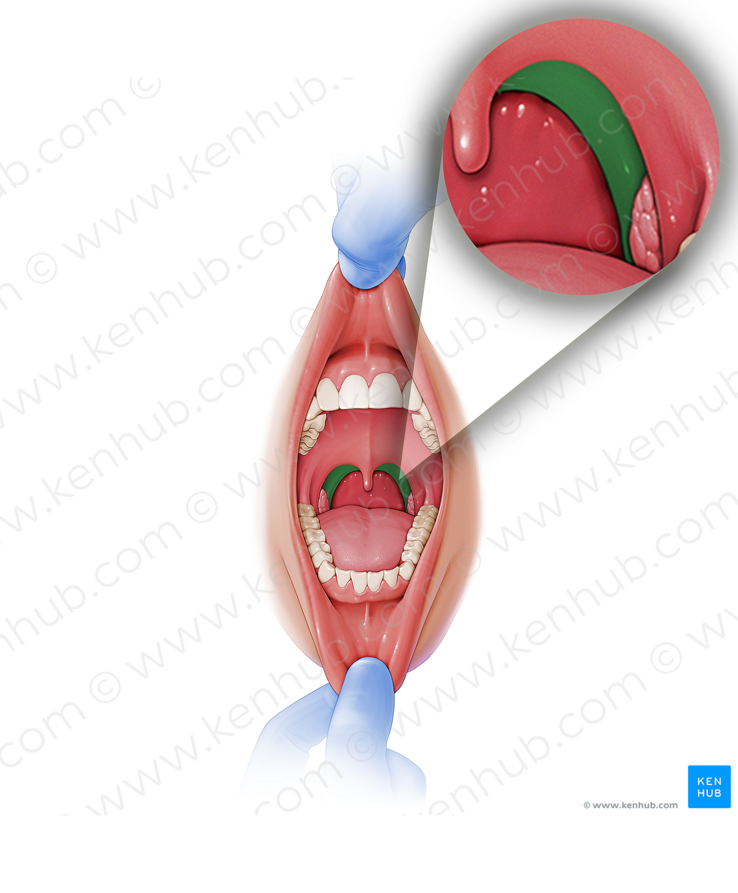 Palatopharyngeal arch (#843)