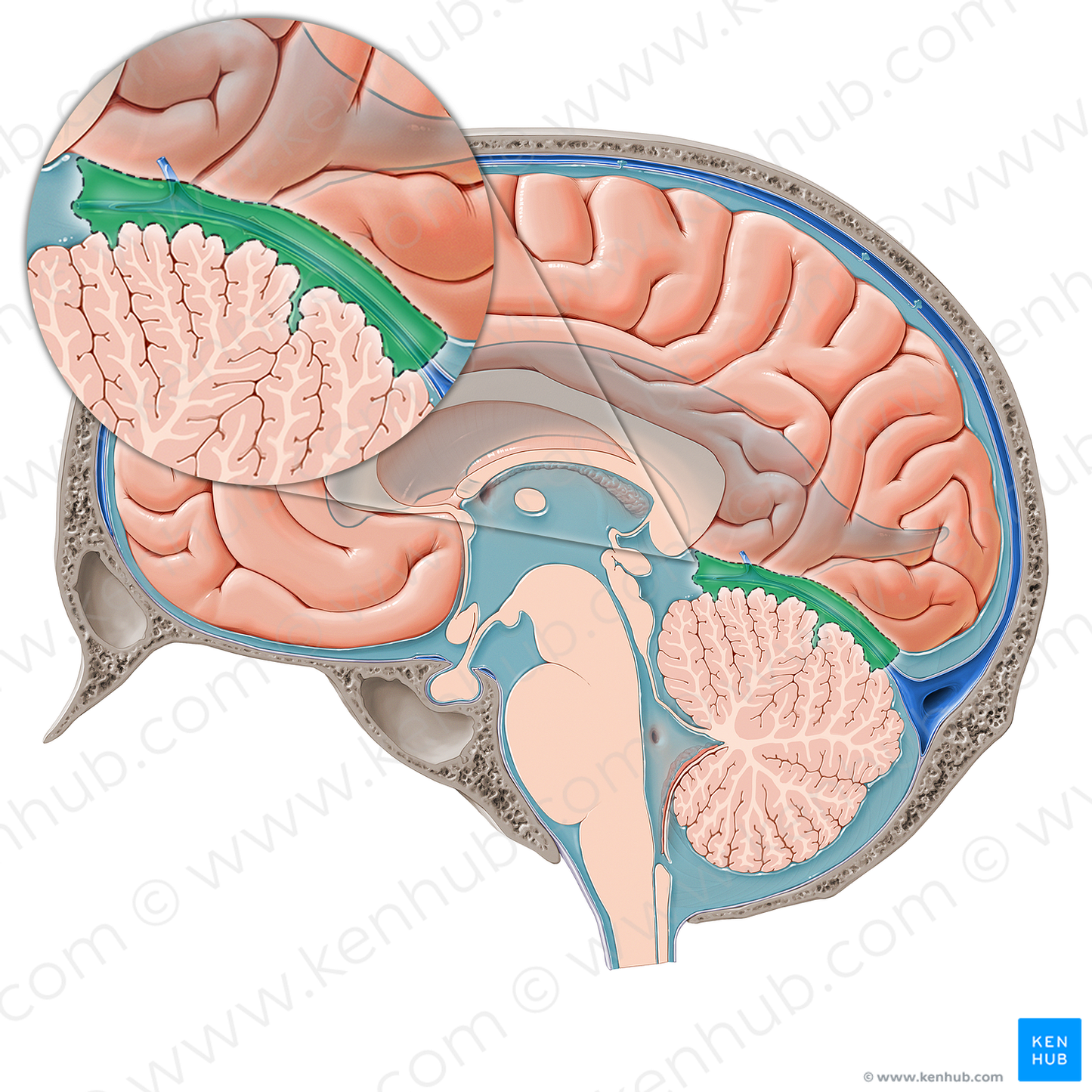 Superior cerebellar cistern (#21419)