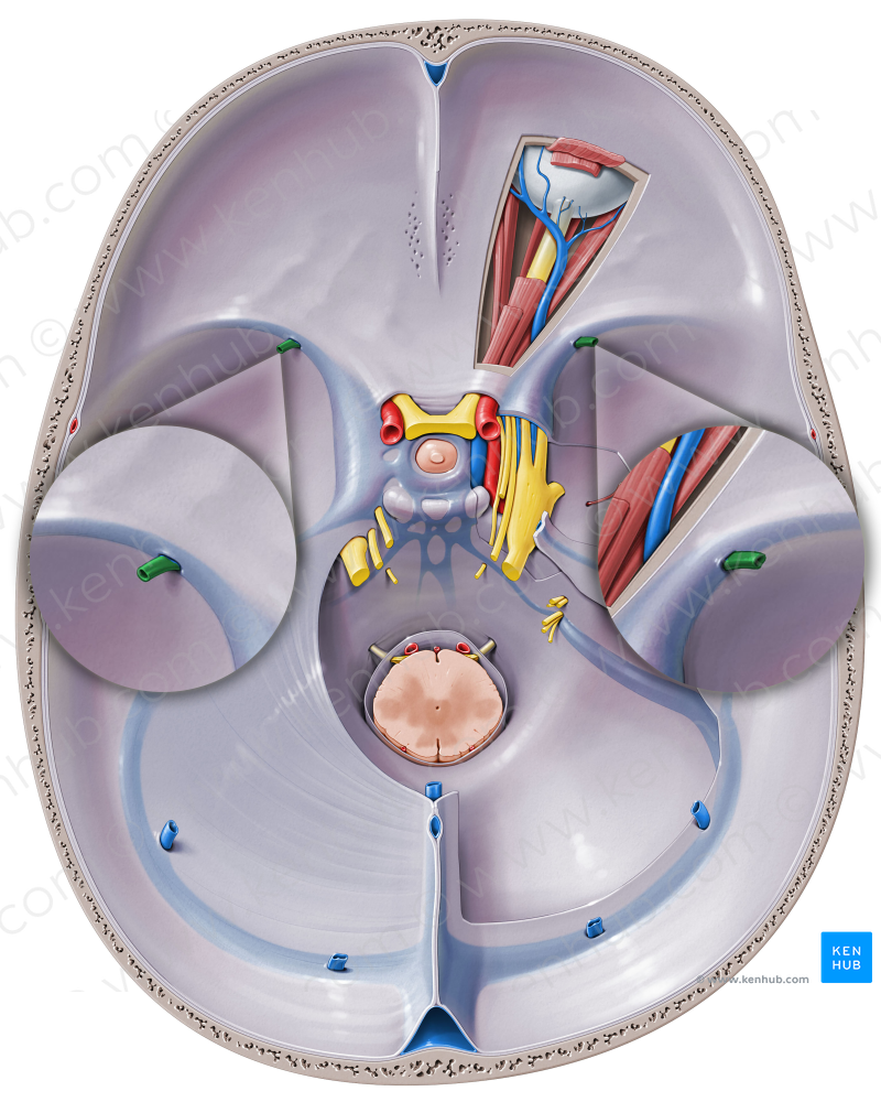 Superficial middle cerebral vein (#10403)