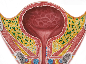 Vesical venous plexus (#8085)