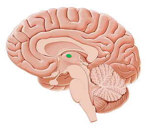 Interthalamic adhesion (#590)