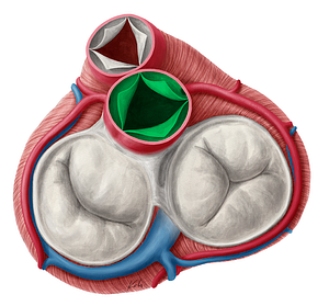 Aortic valve (#9898)