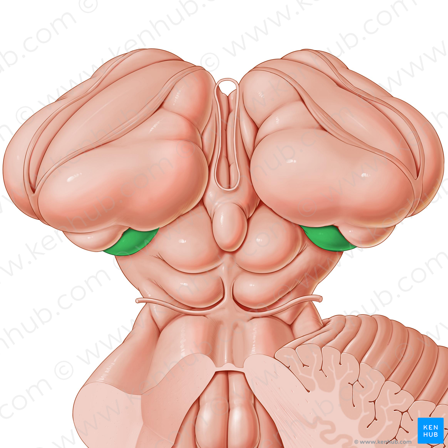 Medial geniculate body (#2945)