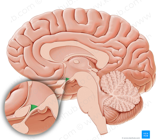 Infundibular recess of third ventricle (#8844)