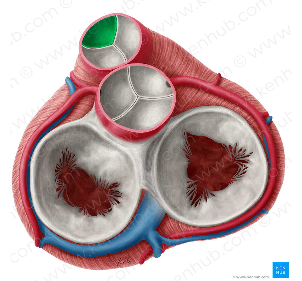 Anterior semilunar leaflet of pulmonary valve (#9917)