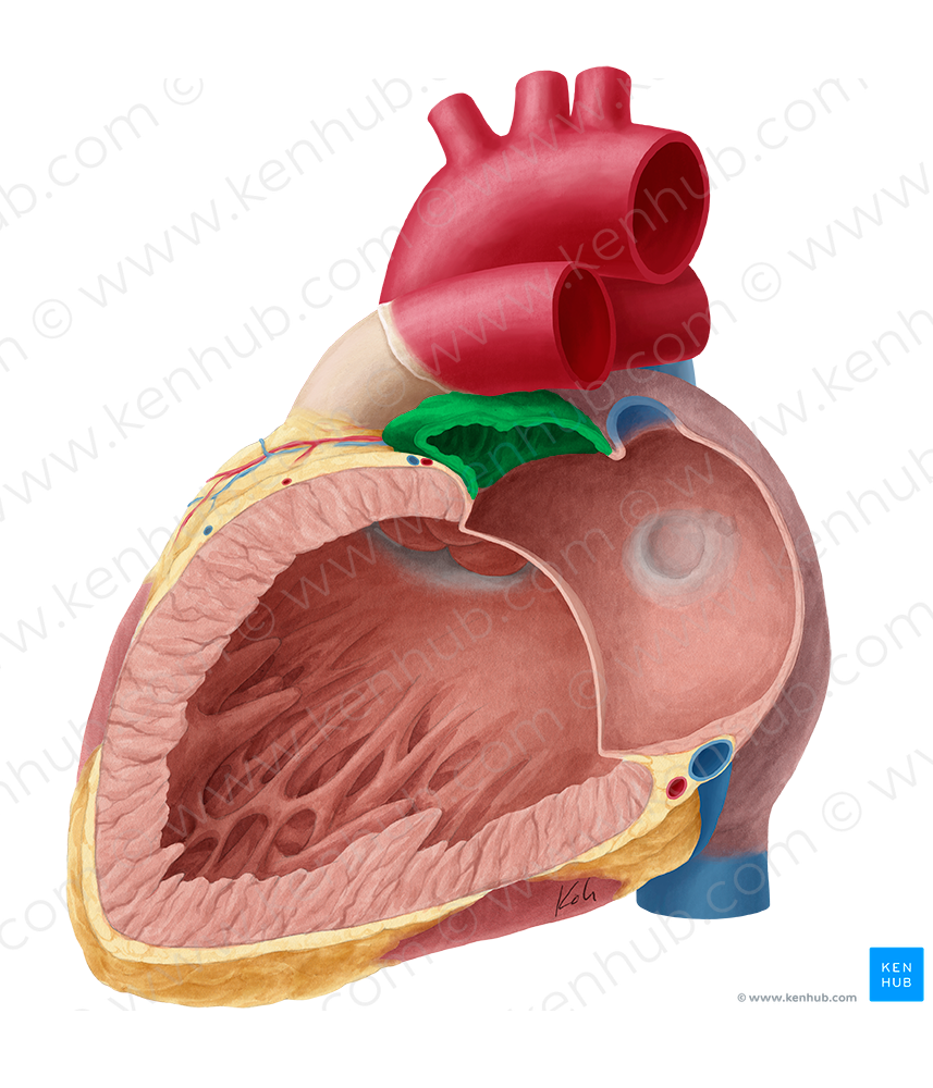 Left auricle of heart (#2132)