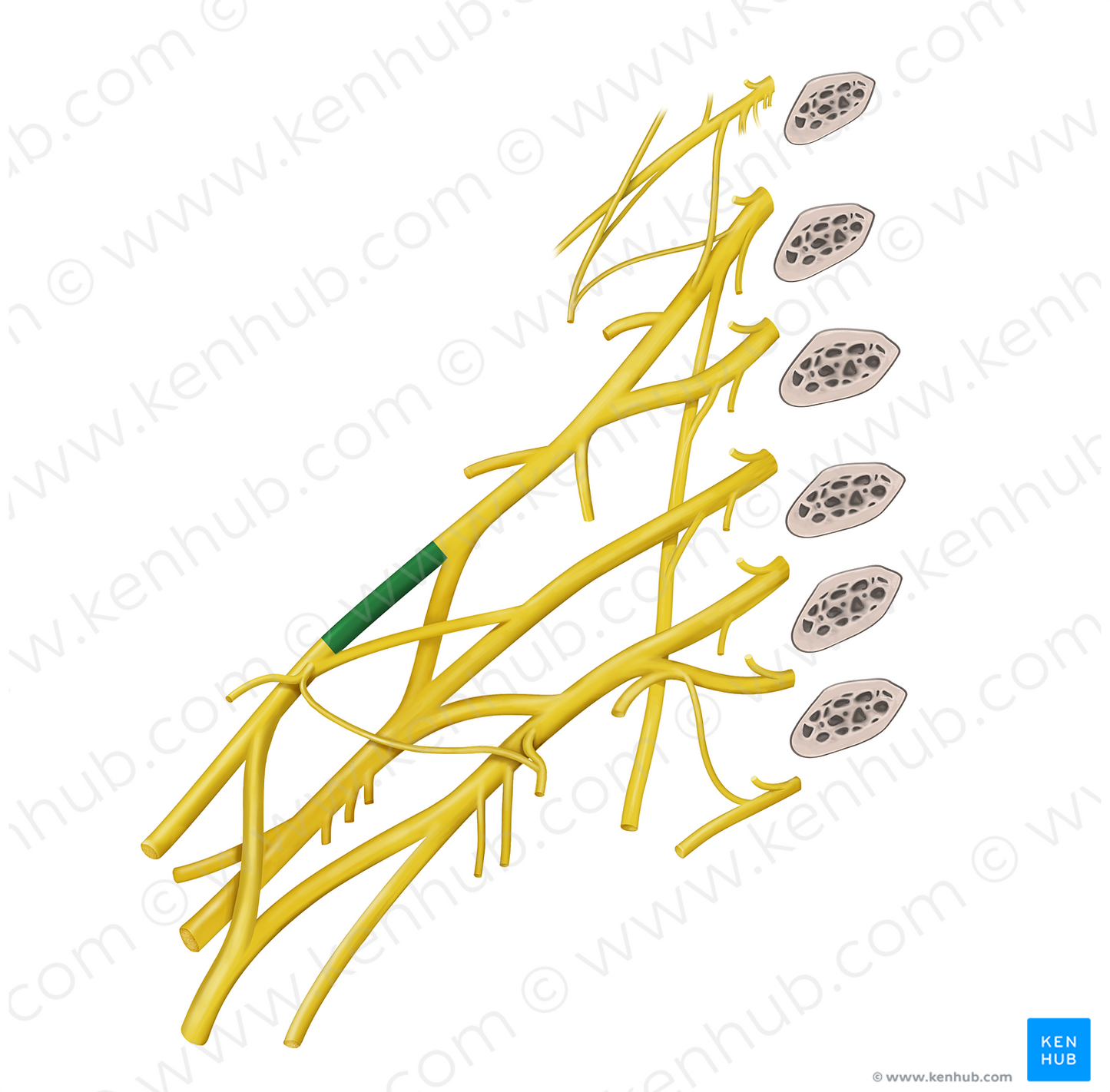 Anterior division of superior trunk of brachial plexus (#20601)