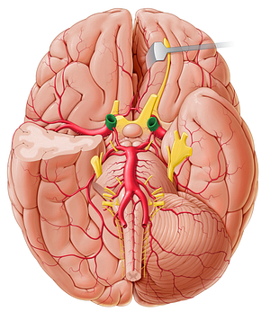 Internal carotid artery (#972)