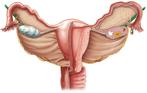 Suspensory ligament of ovary (#4623)