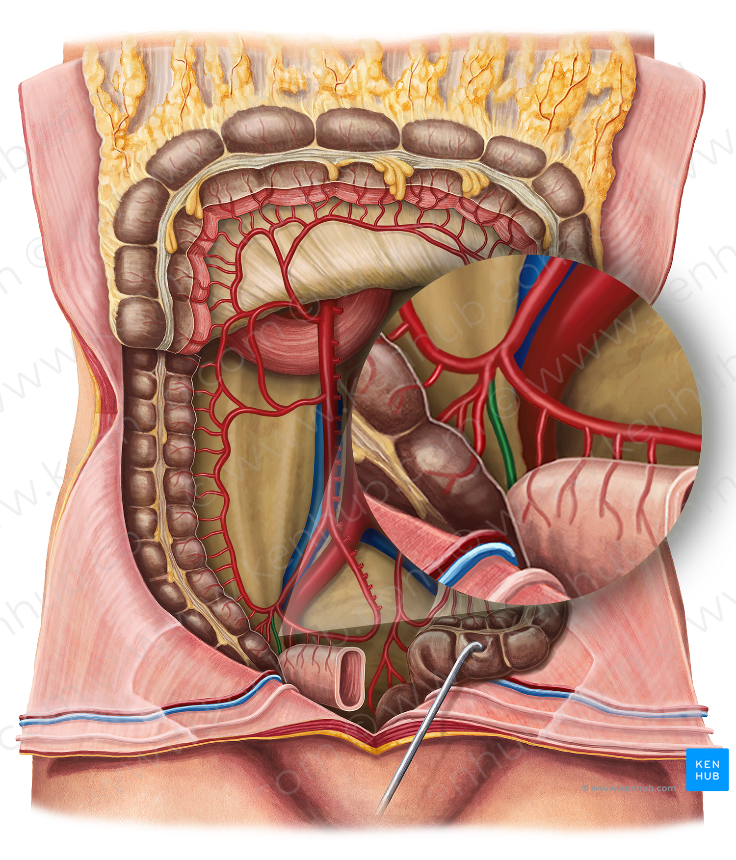 Appendicular artery (#20611)