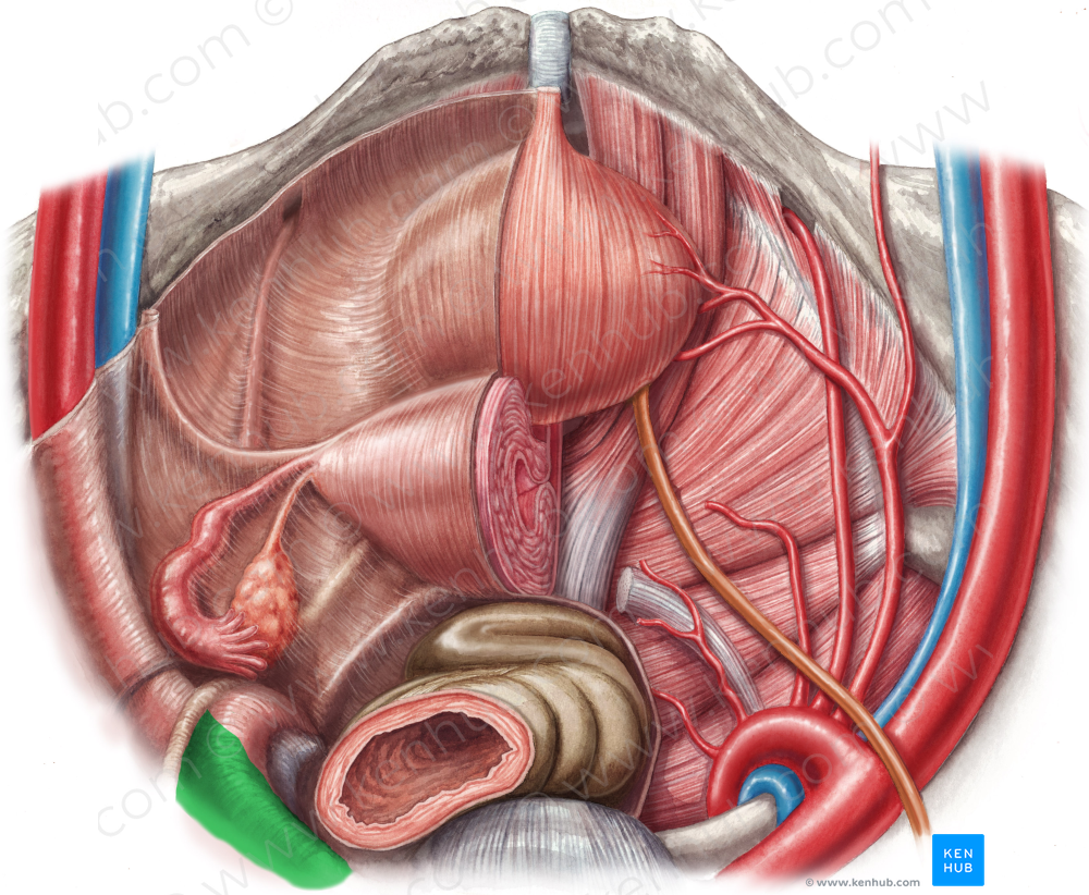 Left common iliac artery (#1385)