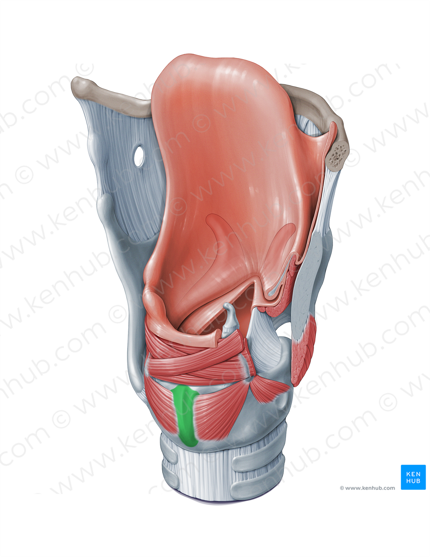 Vertical ridge of lamina of cricoid cartilage (#18364)