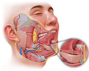 Sublingual caruncle (#2513)