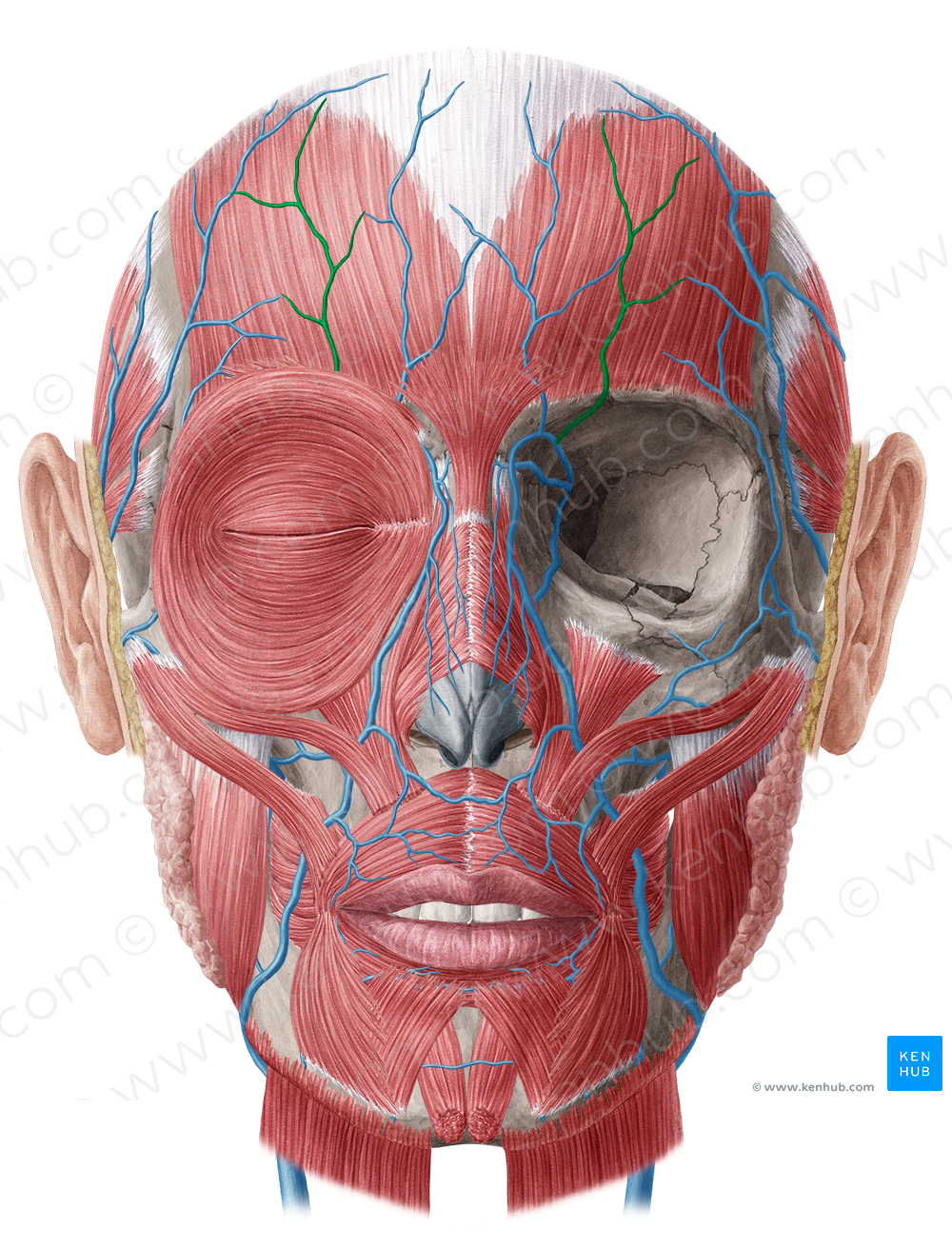 Supraorbital vein (#10618)