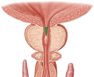 Urethral crest (#3145)