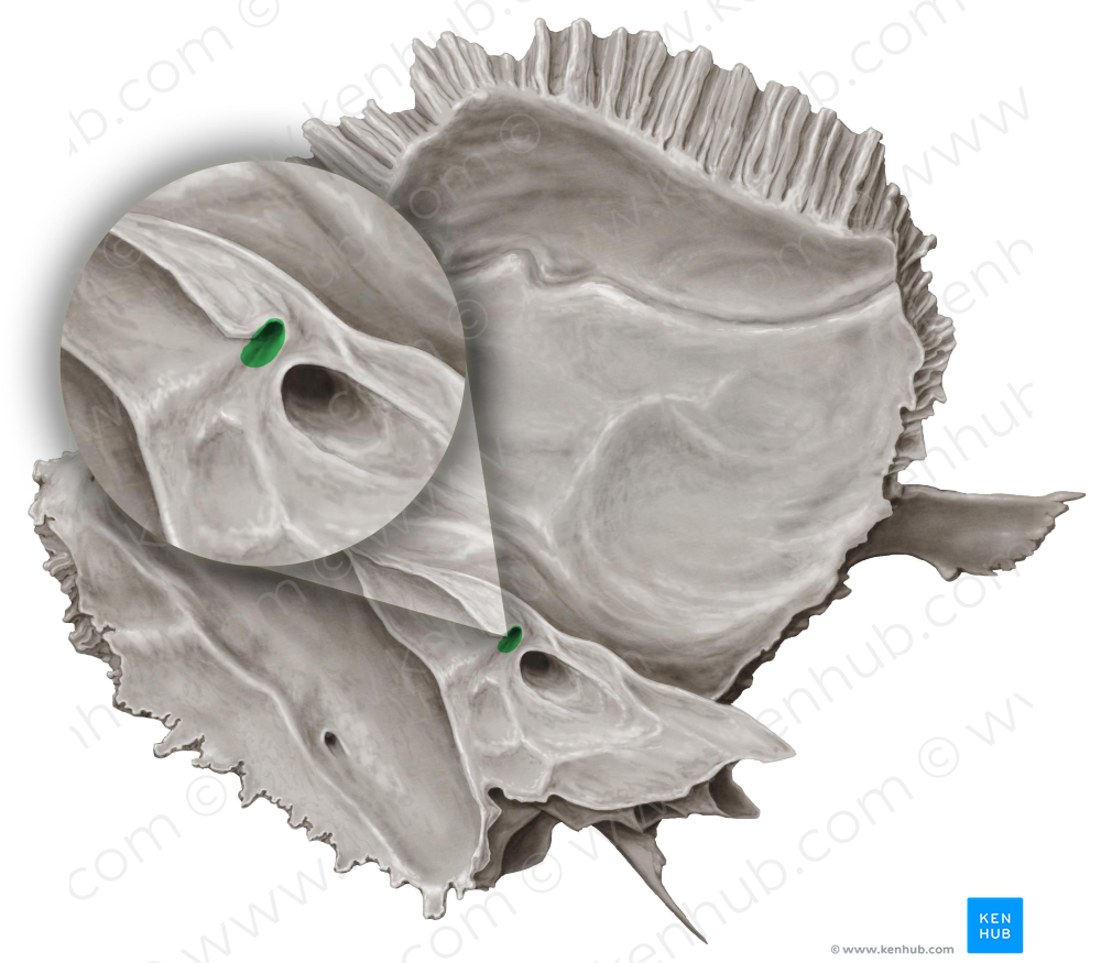Subarcuate fossa of temporal bone (#3884)