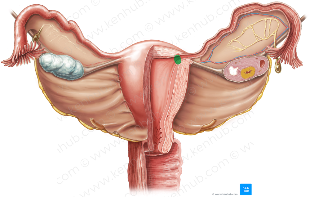 Uterine ostium of uterine tube (#7565)