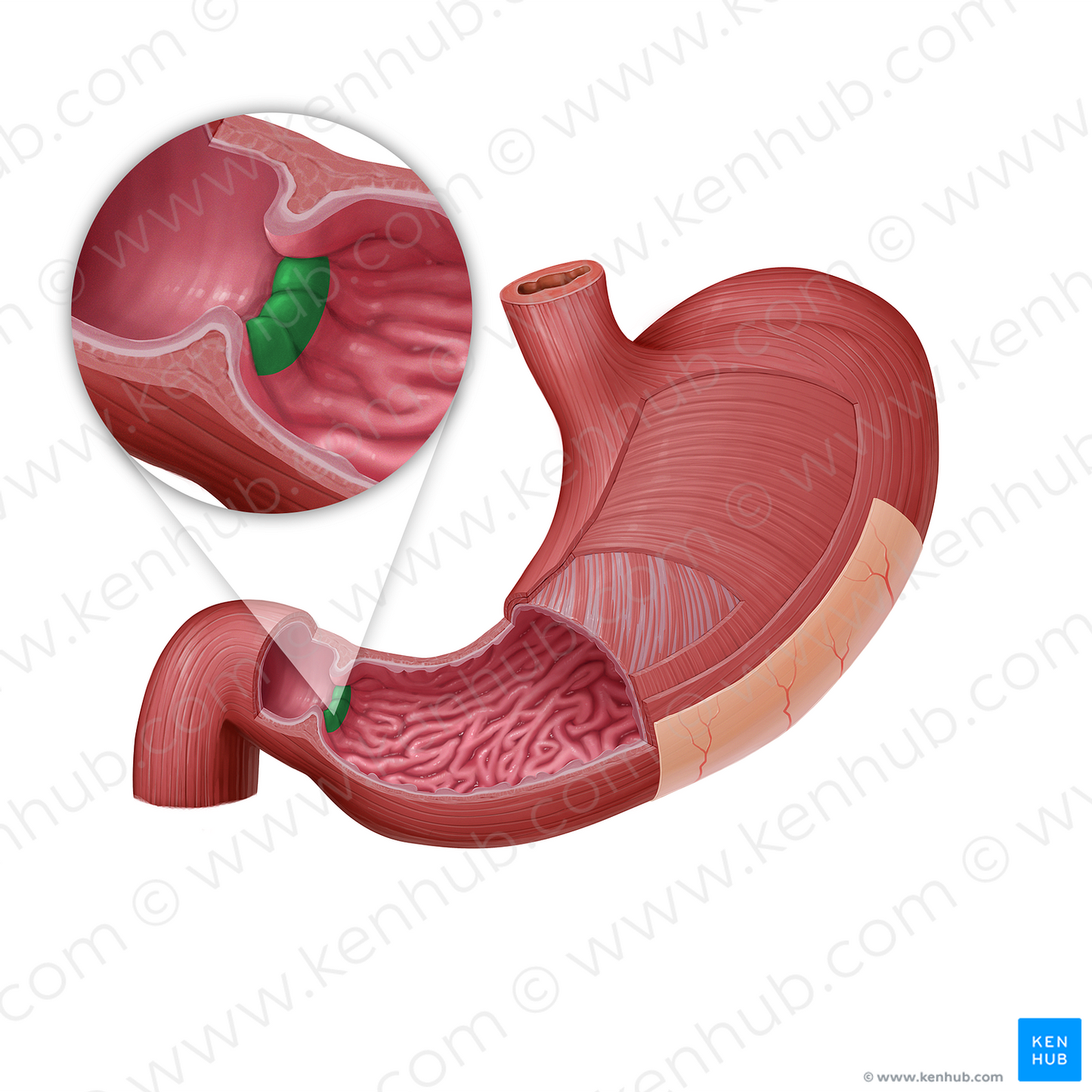 Pyloric orifice (#21593)