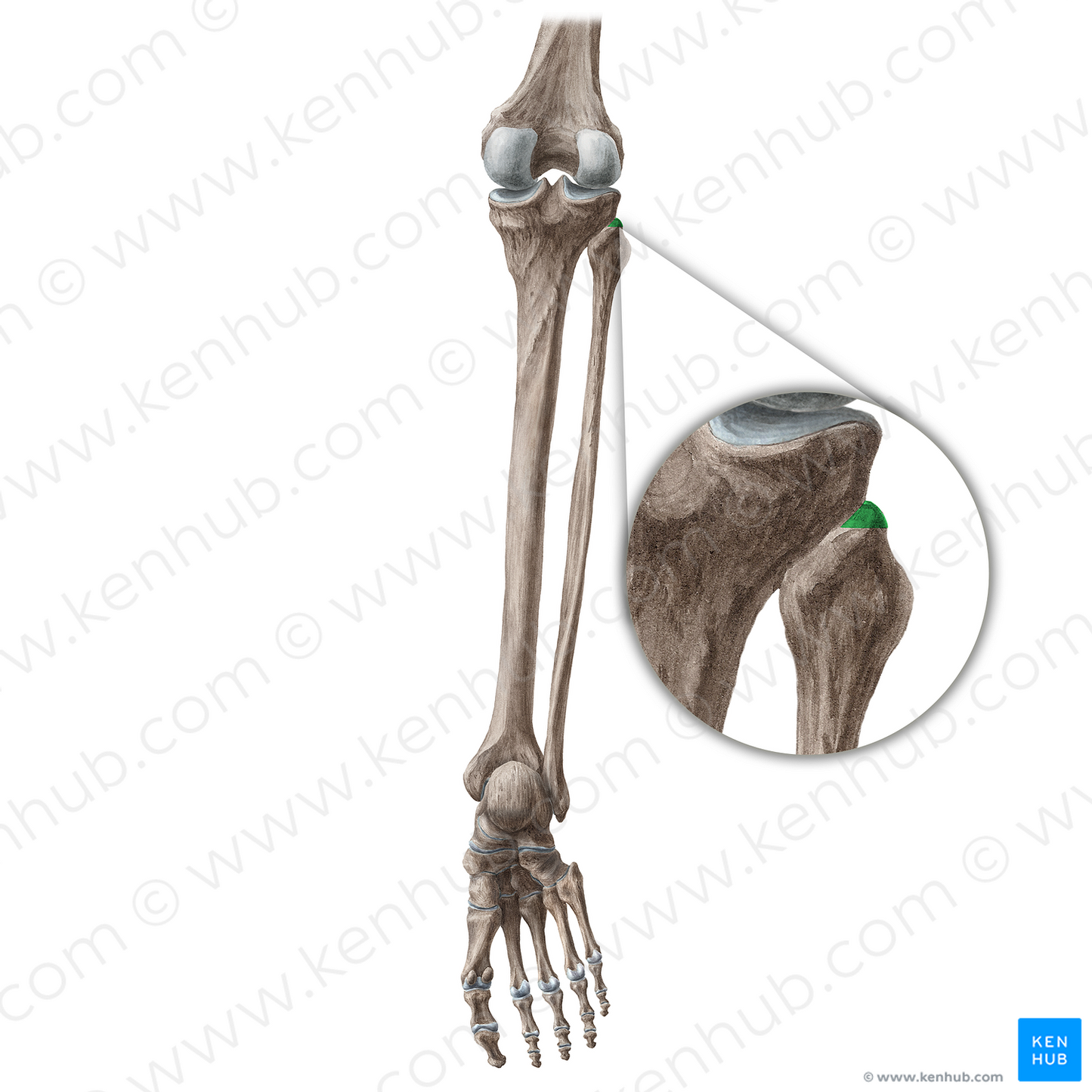 Apex of head of fibula (#20440)