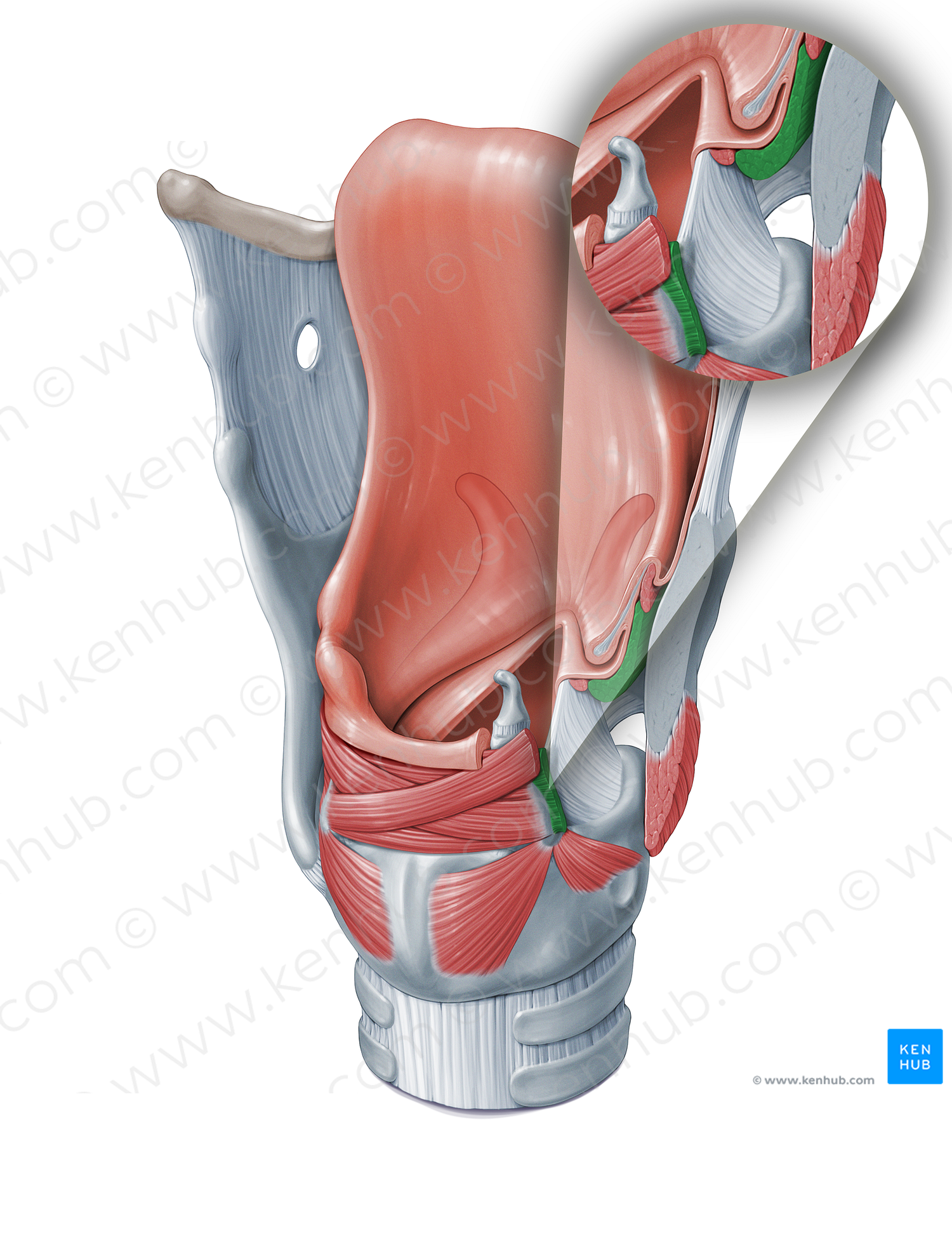 Thyroarytenoid muscle (#18325)