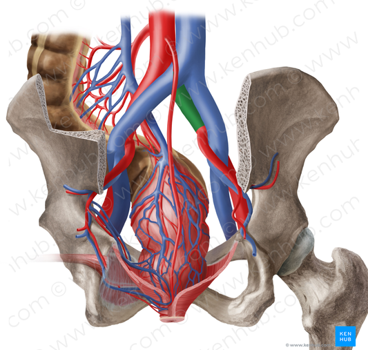 Right common iliac artery (#1378)