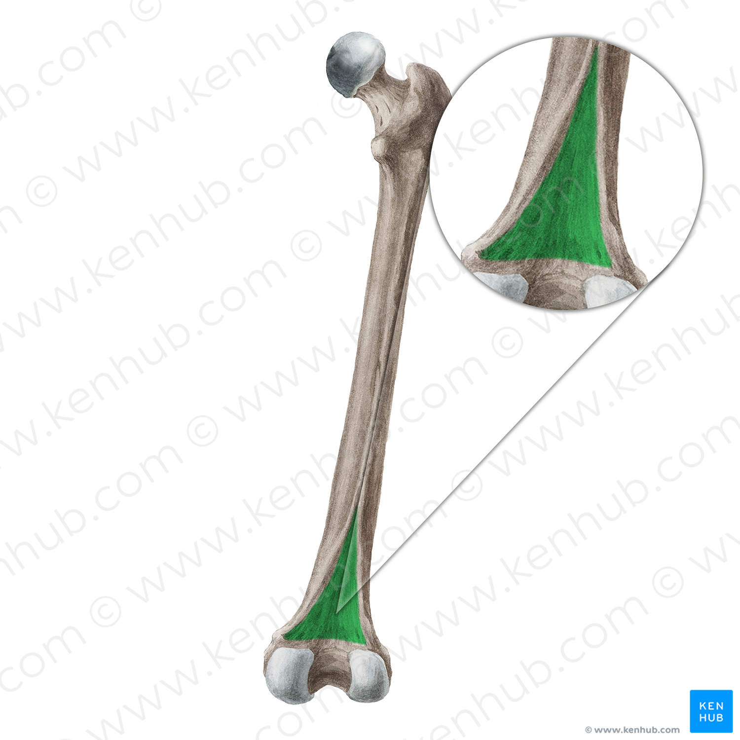 Popliteal surface of femur (#19255)