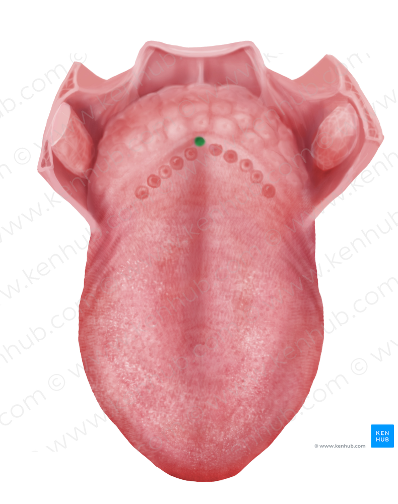 Foramen cecum of tongue (#3729)