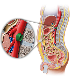 Left renal artery (#1743)