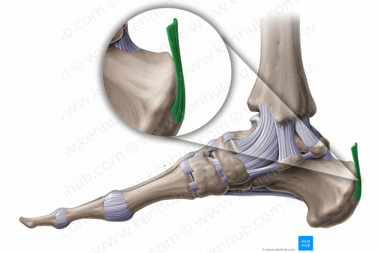 Calcaneal tendon (#11228)