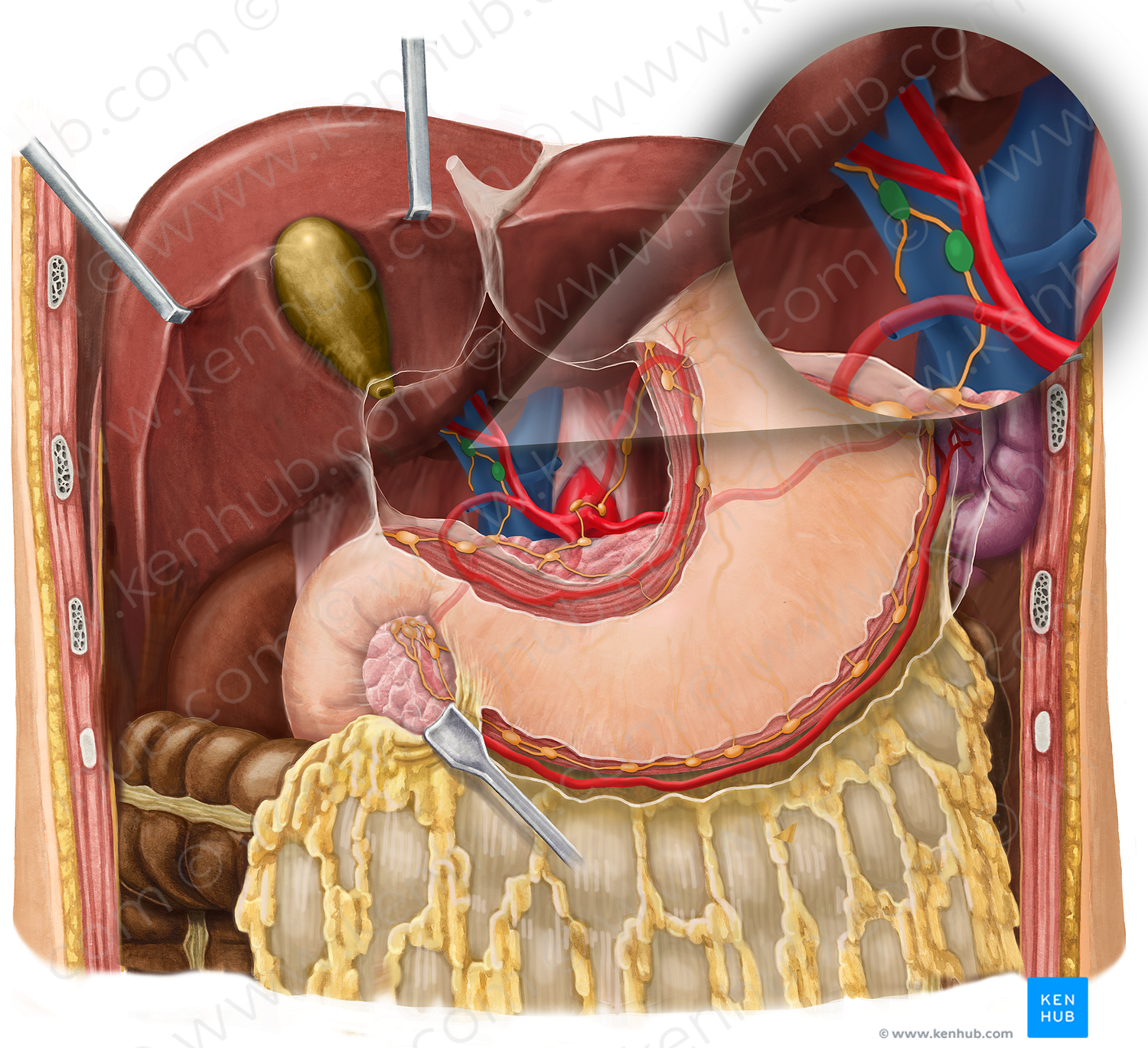 Hepatic lymph nodes (#7005)