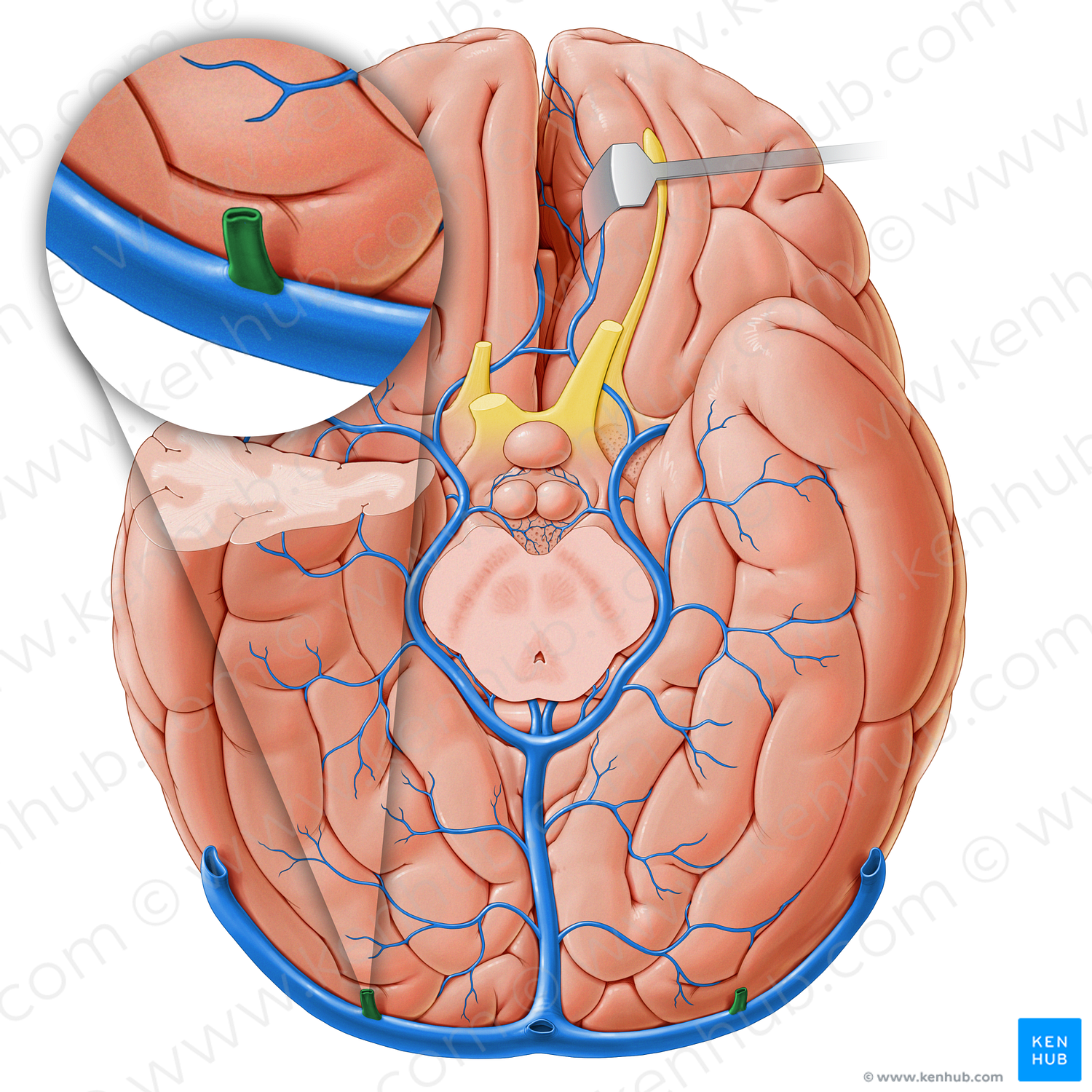 Cerebellar vein (#18249)