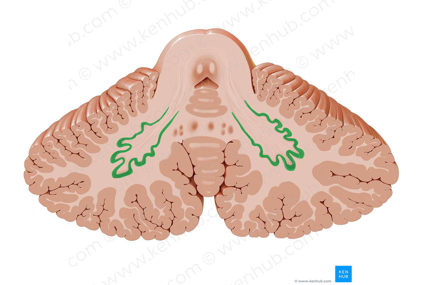 Dentate nucleus (#7185)