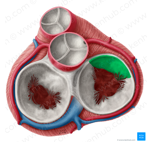 Superior leaflet of right atrioventricular valve (#3181)