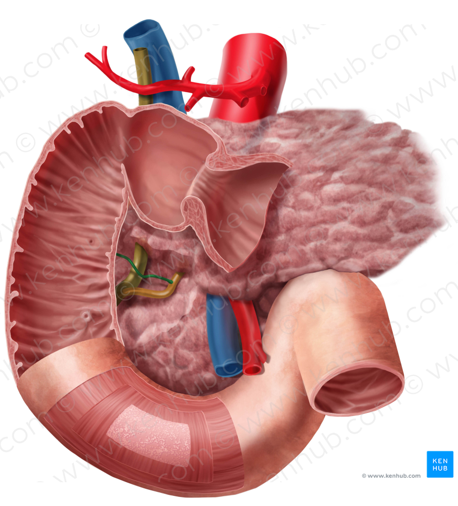 Accessory pancreatic duct (#3338)