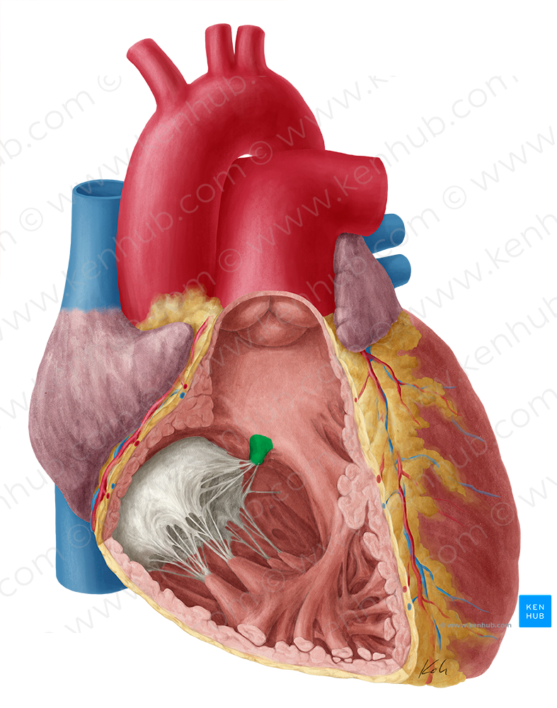 Septal papillary muscle of right ventricle (#5717)