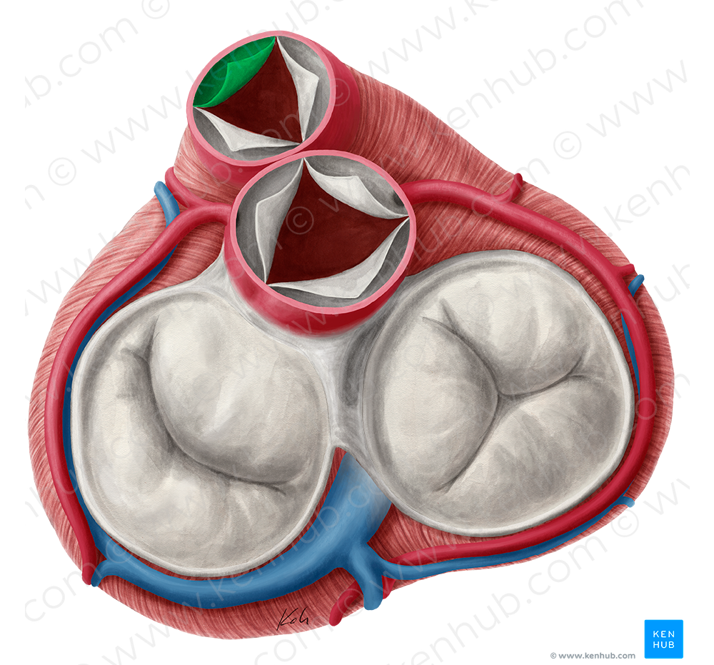 Anterior semilunar leaflet of pulmonary valve (#9918)