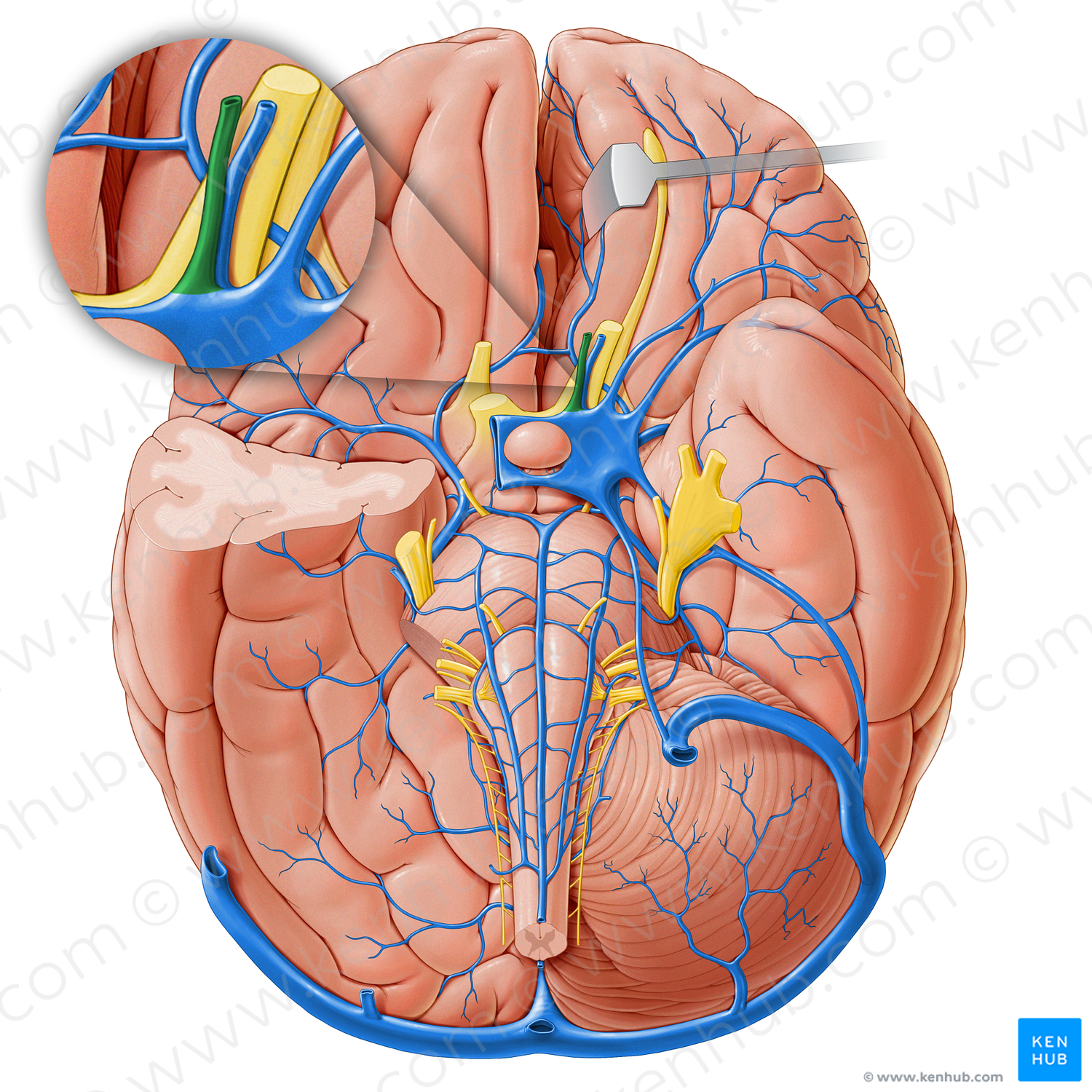 Inferior ophthalmic vein (#18229)