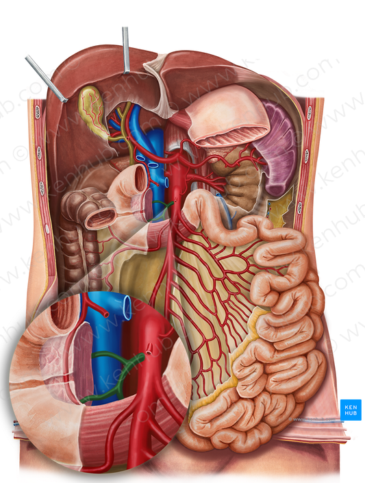 Inferior pancreaticoduodenal artery (#1593)