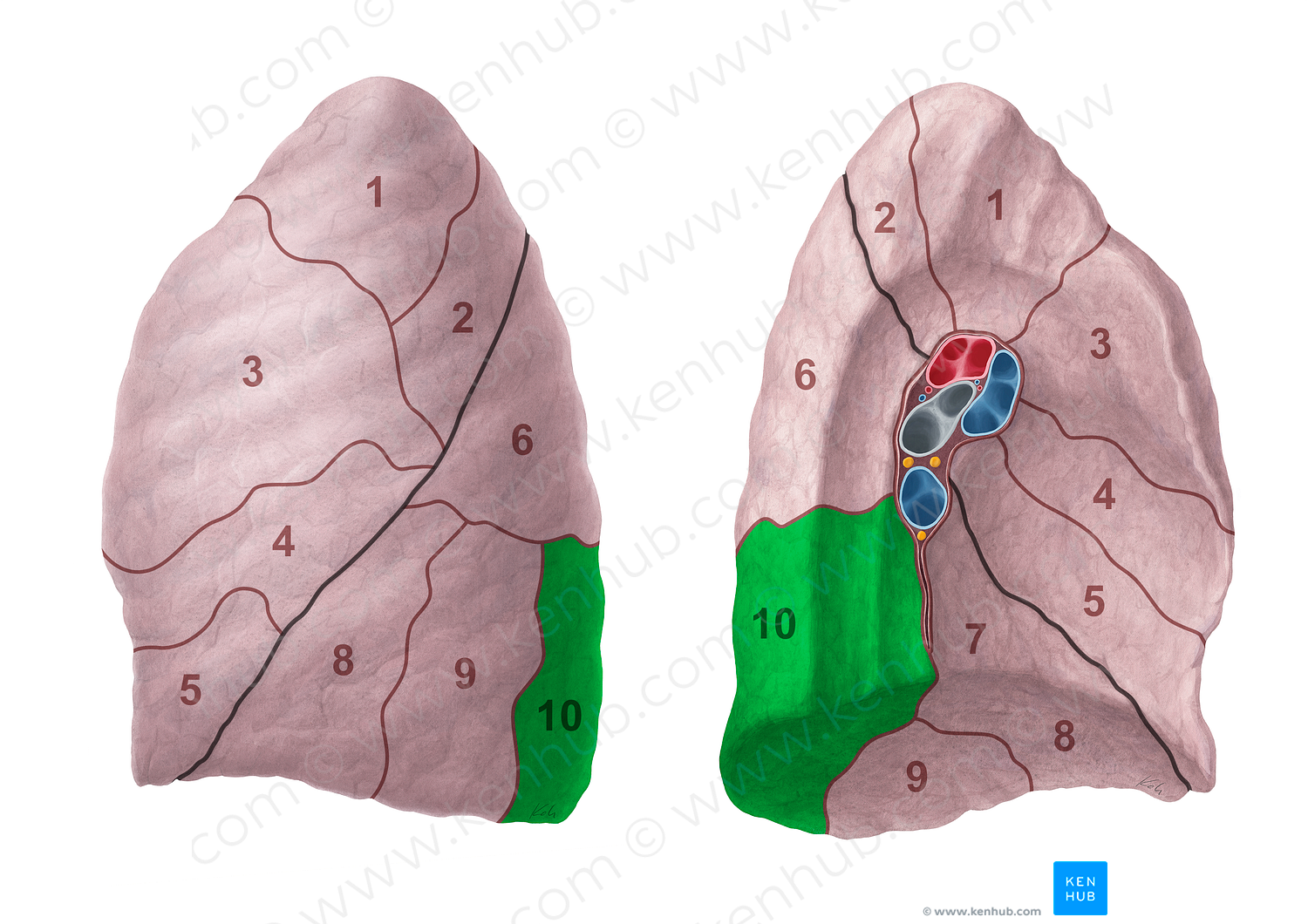 Posterior basal segment of left lung (#20704)