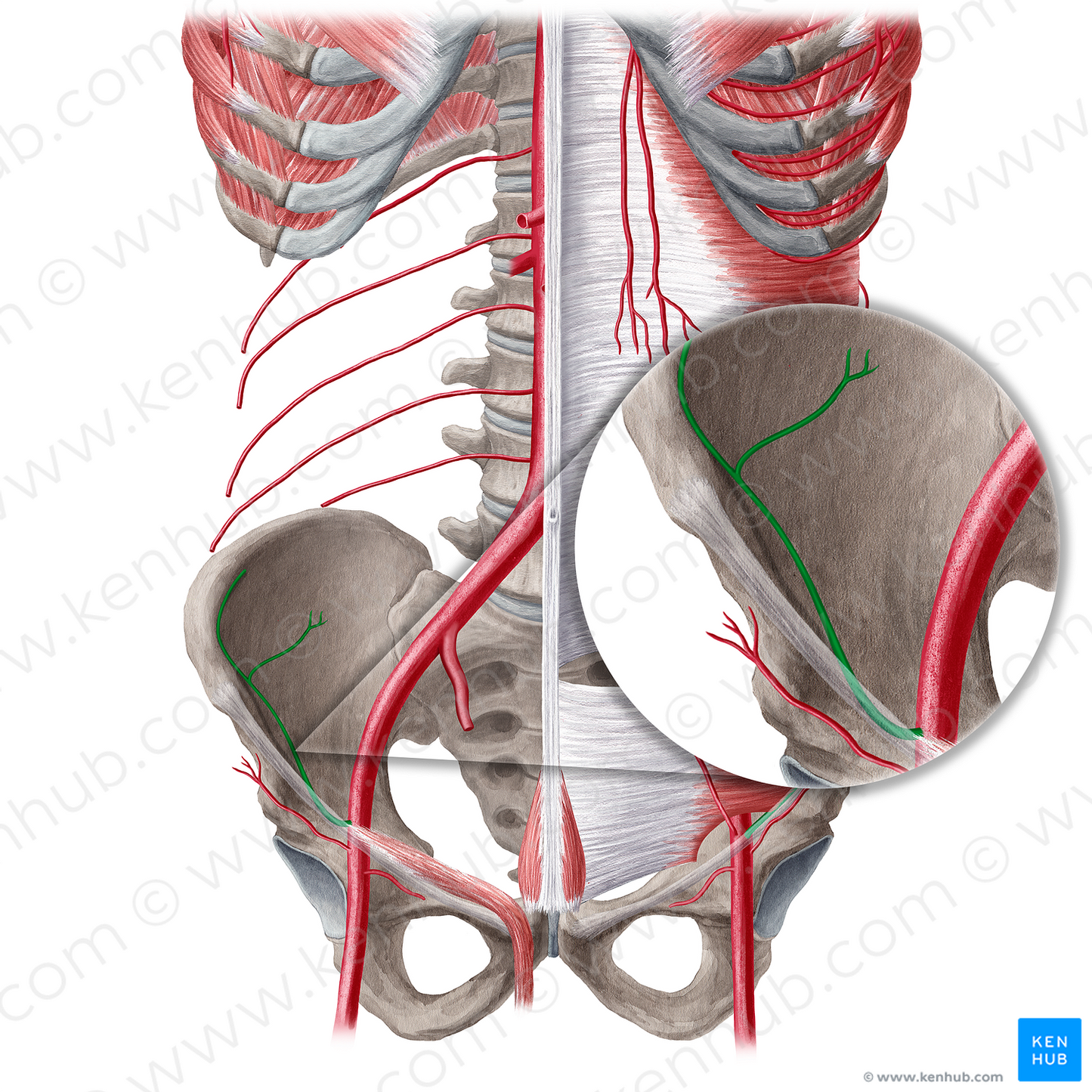 Deep circumflex iliac artery (#21558)