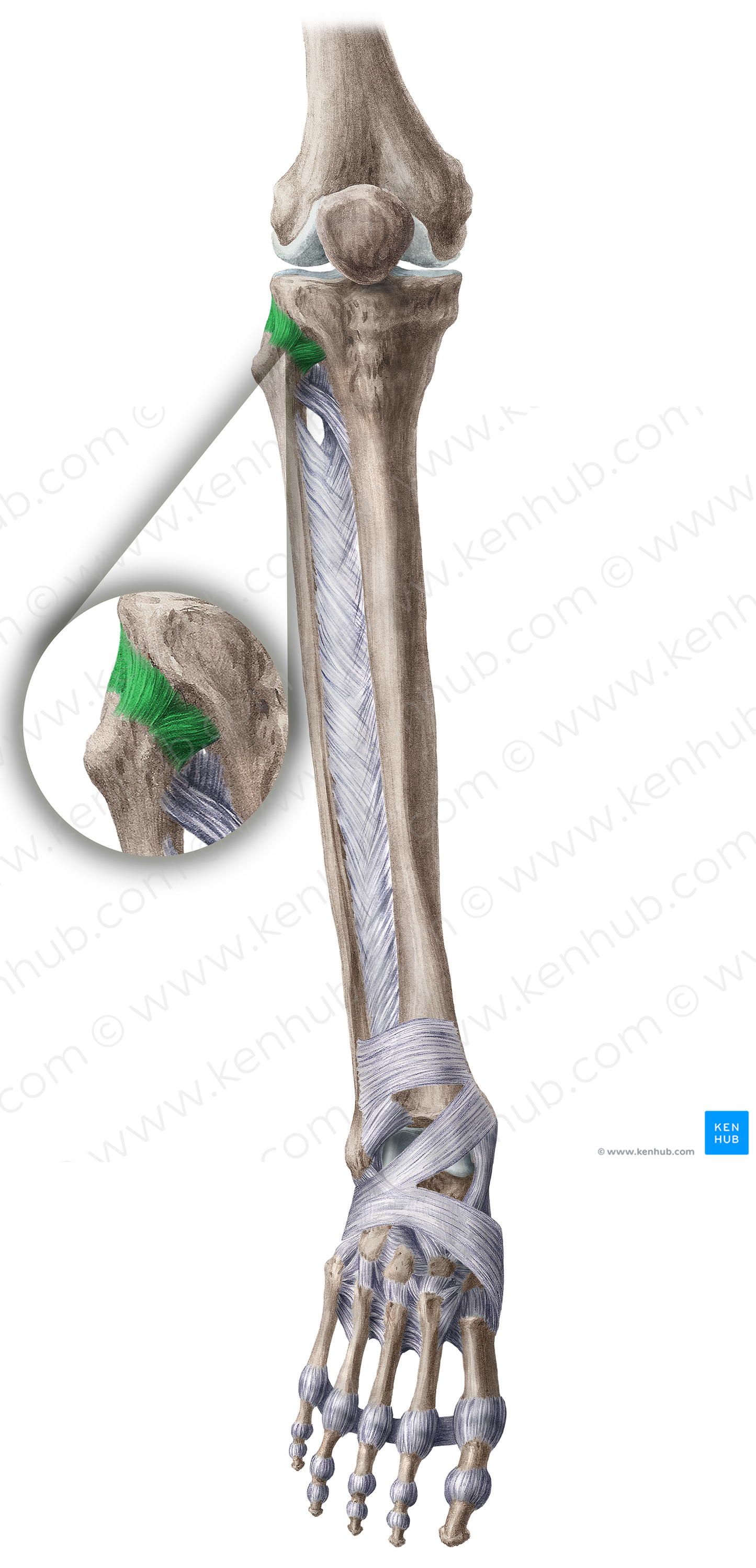 Anterior ligament of head of fibula (#4481)
