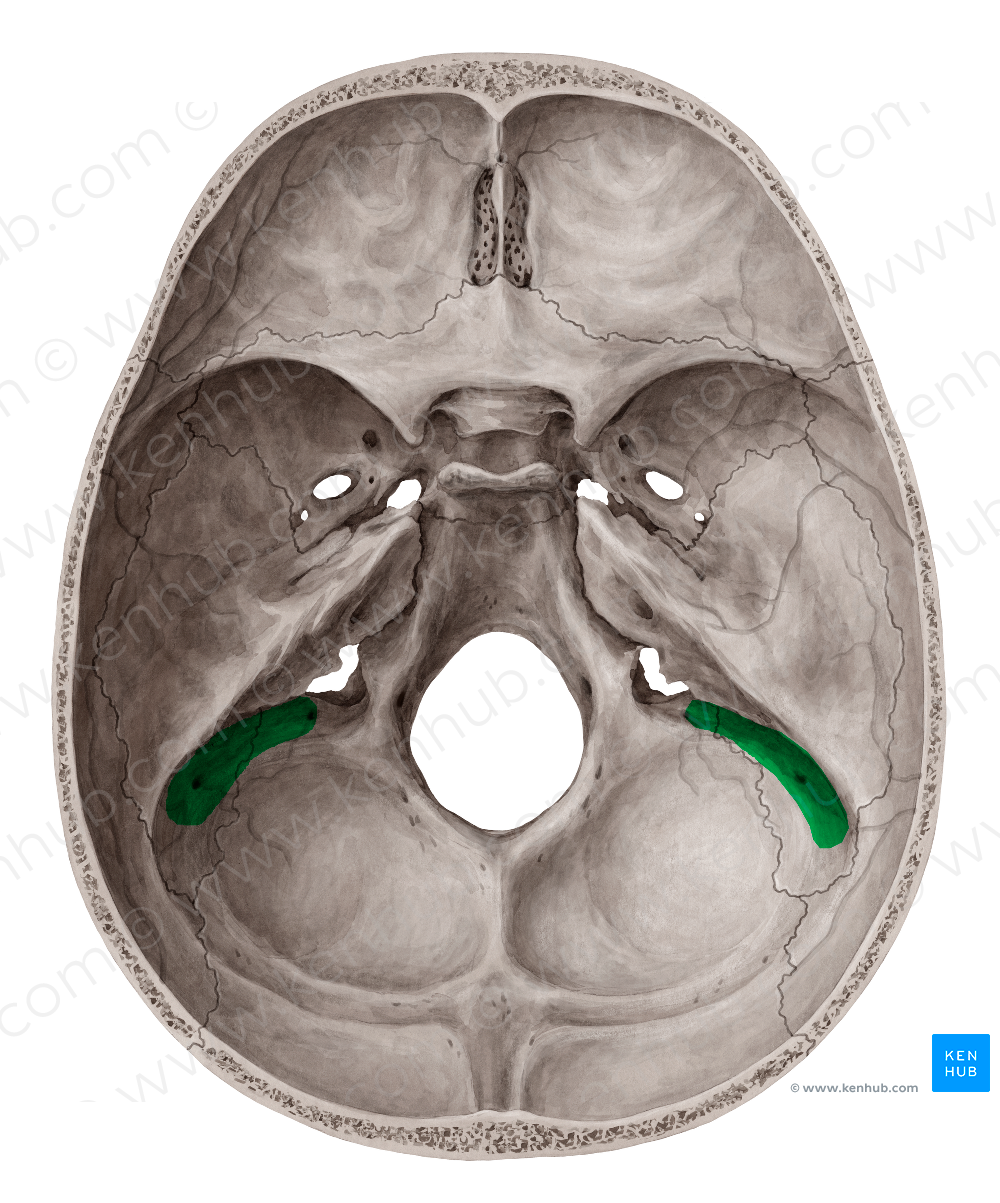 Groove for sigmoid sinus of temporal bone (#9320)