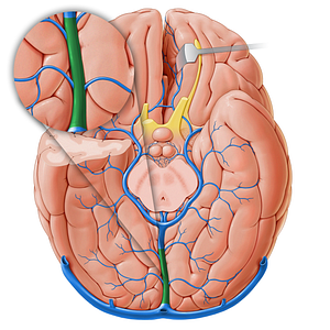 Straight sinus (#18237)