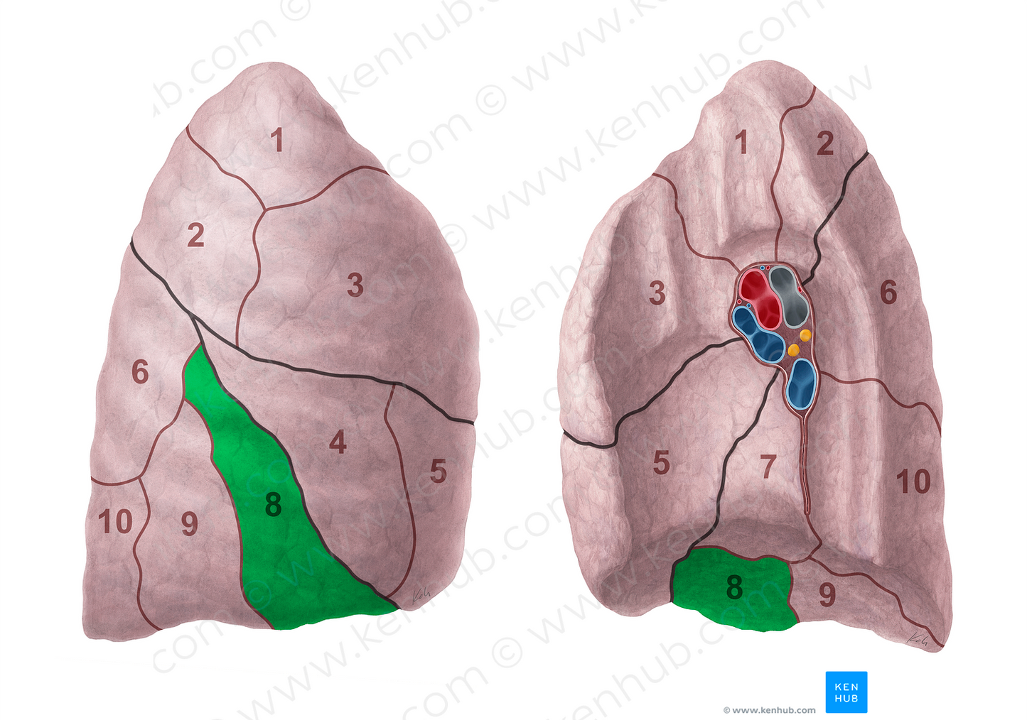 Anterior basal segment of right lung (#20695)
