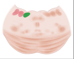 Medial vestibular nucleus (#7274)