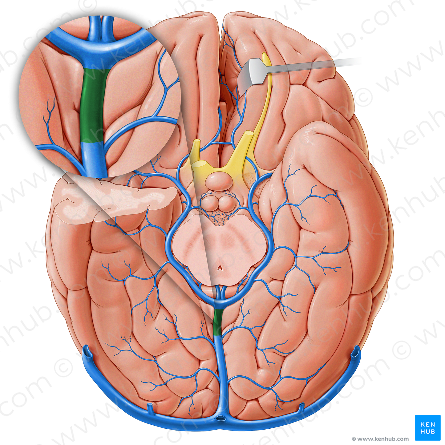 Great cerebral vein (#18228)